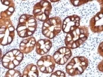 Recombinant EpCAM Antibody [rMOC-31]