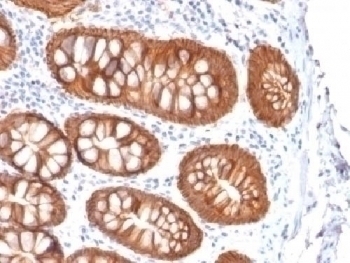 Recombinant EpCAM Antibody [rVU-1D9]