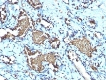 Recombinant Glycophorin A Antibody [GYPA/1725R]