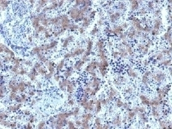 Recombinant Glypican 3 Antibody [GPC3/1534R]