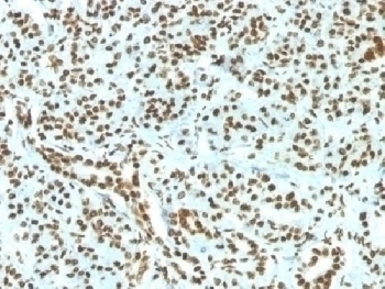 Recombinant Histone H1 Antibody [HH1/1784R]