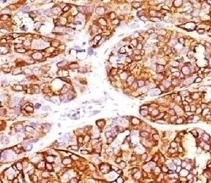 Recombinant MART-1 / Melan-A Antibody [MLANA/1409R]