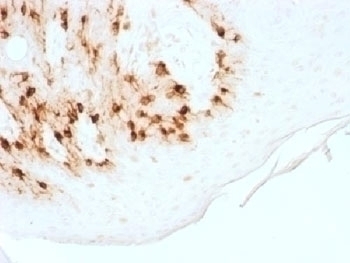 Recombinant MART-1 / Melan-A Antibody [MLANA/1761R]