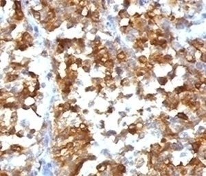 Recombinant MART-1 / Melan-A Antibody [RMMRT1-1]