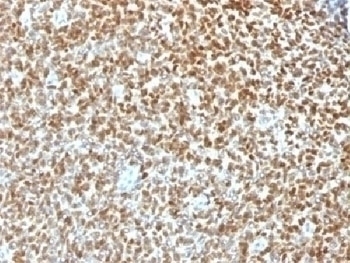 Recombinant NKX2.2 Antibody [NX2/1422R]