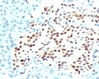 Recombinant NKX2.2 Antibody [RMNK2-1]