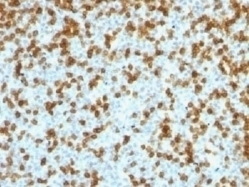 Recombinant PDCD1 / PD-1 Antibody [PDCD1/1410R]