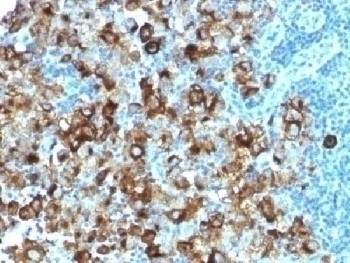 Recombinant PMEL17 / Melanoma gp100 Antibody [PMEL/1825R]