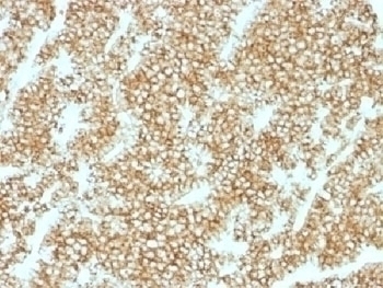 Recombinant Parathyroid Hormone Antibody [PTH/1717R]