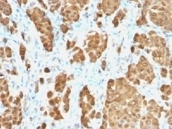 Recombinant S100B Antibody [S100B/1706R]