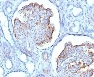 Recombinant WT1 Antibody [RMWT1-1]