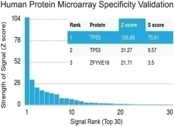 Recombinant p53 Antibody [TP53/1799R]