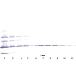 To detect hResistin by Western Blot analysis this antibody can be used at a concentration of 0.1 - 0.2 ug/ml. Used in conjunction with compatible secondary reagents the detection limit for recombinant hResistin is 1.5 - 3.0 ng/lane, under either reducing or non-reducing conditions.