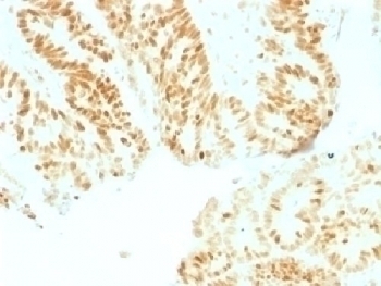 Retinoblastoma / Rb Antibody [RB1/1754]