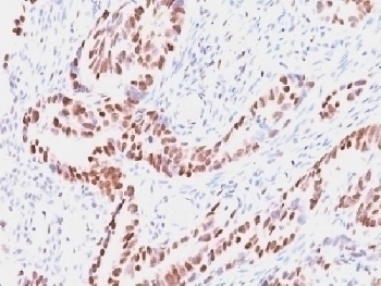 Retinoblastoma / Rb Antibody [SPM353]