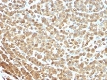 S100A Antibody [S1-61]