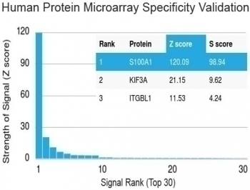 S100A1 Antibody [S100A1/1942]