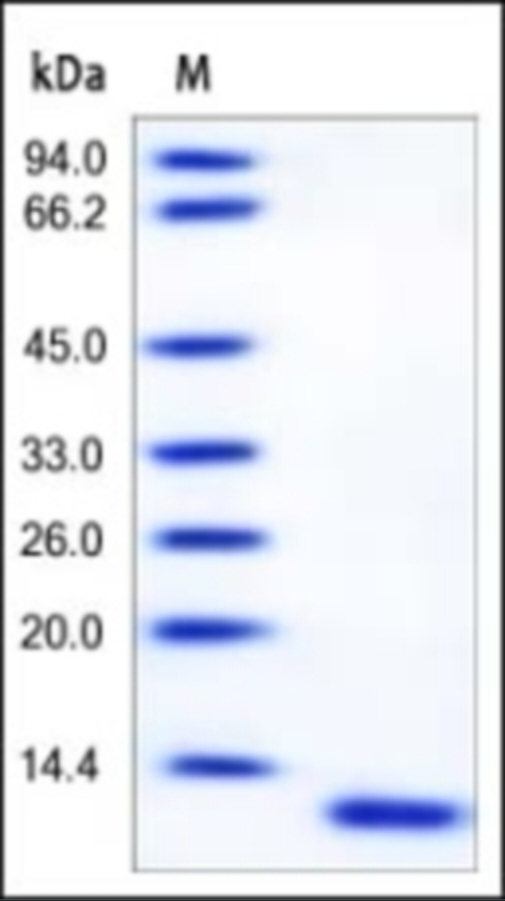 S100A6 Recombinant Protein