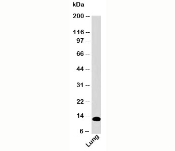 S100A8 Antibody [SA6279]