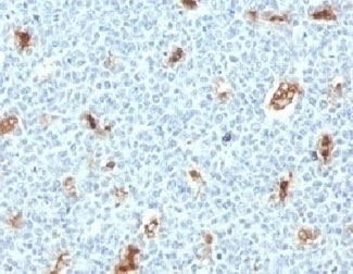 S100A9 Antibody [PS1A9-1]