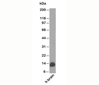 S100B Antibody [4C4.9]