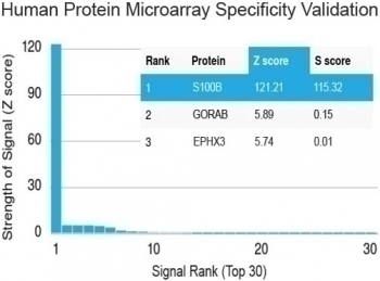 S100B Antibody [PS1B1-1]