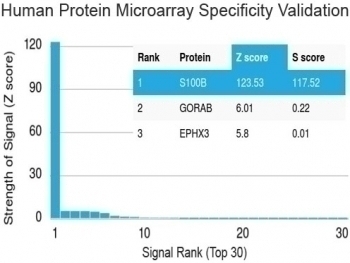 S100B Antibody [S100B/1012]