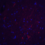 Immunofluorescence of S1PR2 in mouse brain tissue with S1PR2 antibody at 20 μg/ml.<br><br>Red: S1PR2 Antibody (8229) <br> Blue: DAPI staining