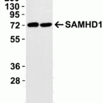 <strong>Figure 2 Overexpression Validation in 293T Transfected Cells</strong><br>Loading: 15 μg of lysates per lane.Antibodies: SAMHD1 8007 (0.1 μg/mL), (1h incubation at RT in 5% NFDM/TBST.Secondary: Goat anti-rabbit IgG HRP conjugate at 1:10000 dilution.293 cells were transfected with (1) wild-type SAMHD1 or (2) SAMHD1 (mutation T592A).