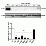 <strong>Figure 6 Overexpression Validation of SAMHD1 in CD4+ T-cells from a healthy donor and transformed CD4+ T-cell lines (Kohnken et al.,  2017) </strong><br>MT1, MT2, SLB-1, and C8166 were from leukemia patients and HH, HuT78, and HuT102  were from cutaneous T-cell lymphoma (CTCL) patients.  SAMHD1 protein expression detected by anti-SAMHD1 antibodies (8007) was significantly increased in normal CD4+ T-cells as compared to leukemia- and CTCL- derived CD4+ T-cell lines. This blot is representative from four independent experiments with four healthy donors.