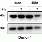 <strong>Figure 8 Regulated Expression Validation of SAMHD1 in CD4+ T-cells from a healthy donor (Kohnken et al.,  2017)</strong><br>SAMHD1 protein expression detected by anti-SAMHD1 antibodies (8007) was significantly decreased by about 40% relative to control cells at 48hr post-nucleofection with miR-181b.