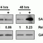 <strong>Figure 9 Regulated Expression Validation of SAMHD1 in MT2 CD4+ T-cells from leukemia patients(Kohnken et al.,  2017)</strong><br>SAMHD1 protein expression detected by anti-SAMHD1 antibodies (8007) was significantly increased by 5-fold at 48hr post-nucleofection with miR-181family inhibitor treatment.