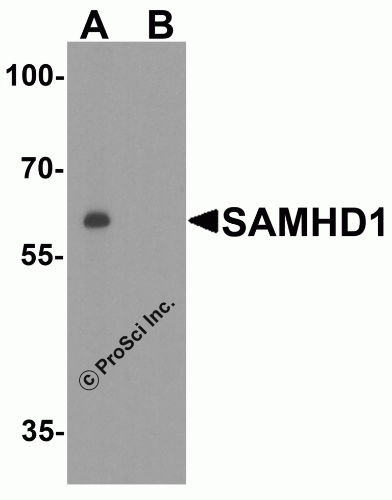 SAMHD1 Peptide