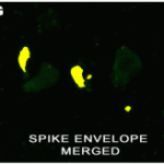 <strong>Figure 2  IHC/IF Validation in COVID-19 Patient Sample  </strong><br>  (Nuovo et al., 2020)Detection of SARS-CoV-2 proteins in nasopharyngeal swab cell preparationsF-H. Co-expression of spike detected by spike antibodies (3525) and envelope proteins detected by envelope antibodies (3531) of SARS-CoV-2 (panel F) documented localization of each protein to glandular cells with negative squamous cells two weeks after full recovery (panel G, signal yellow). No signal was seen in oral swabs of positive cases (panel H). <strong>Both the spike and envelope protein detected by anti-spike antibodies (3525,  0.2 μg/mL) and anti-envelope antibodies (3531, 2 μg/mL) produced a signal in the nasopharyngeal swabs of the three cases and no signal was evident in the nasopharyngeal swabs of the seven controls. </strong>