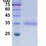 SDS-PAGE Image