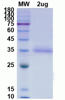 SARS-CoV-2 (COVID-19) CAL.20C (B.1.429) S RBD (L452R) Recombinant Protein