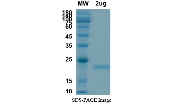 SARS-CoV-2 (COVID-19) E Recombinant Protein