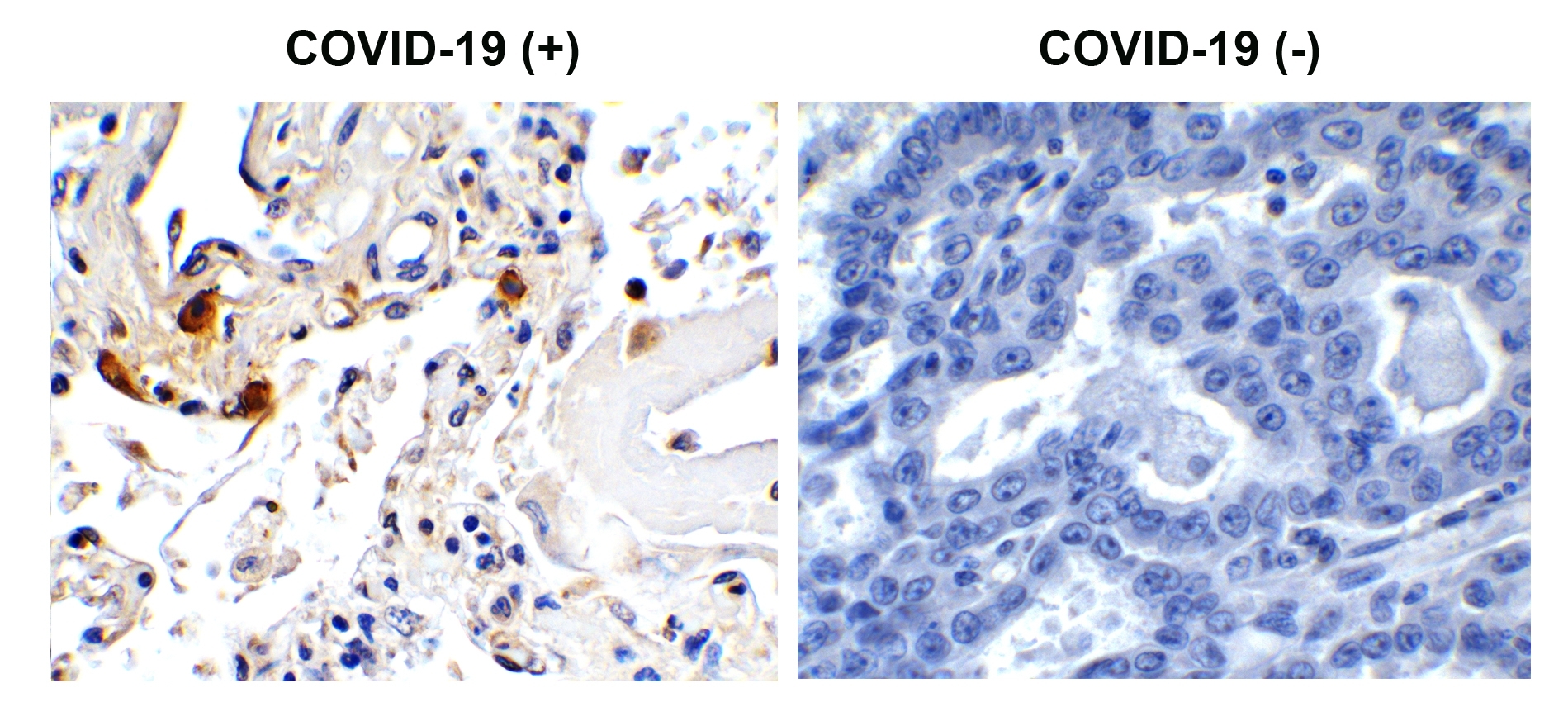 SARS-CoV-2 (COVID-19) Envelope antibody