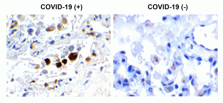 SARS-CoV-2 (COVID-19) Membrane Antibody