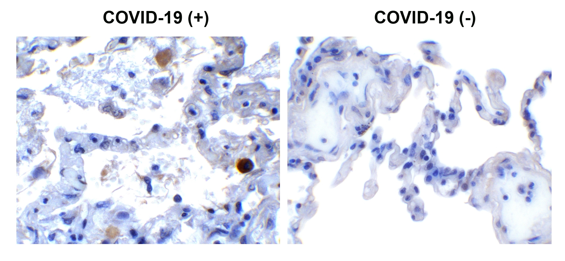 SARS-CoV-2 (COVID-19) NSP13 (Helicase) Antibody