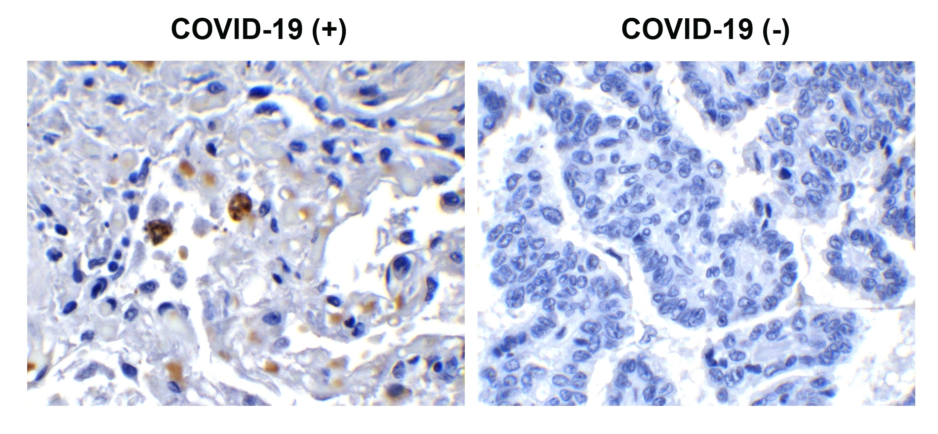 SARS-CoV-2 (COVID-19) NSP13 (Helicase) Antibody