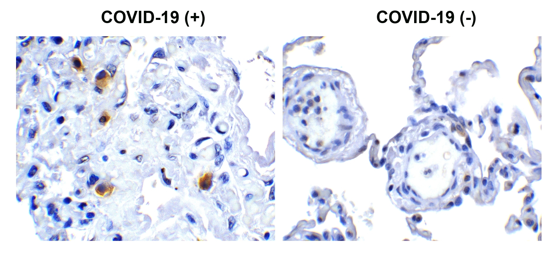 SARS-CoV-2 (COVID-19) NSP14 (ExoN) Antibody