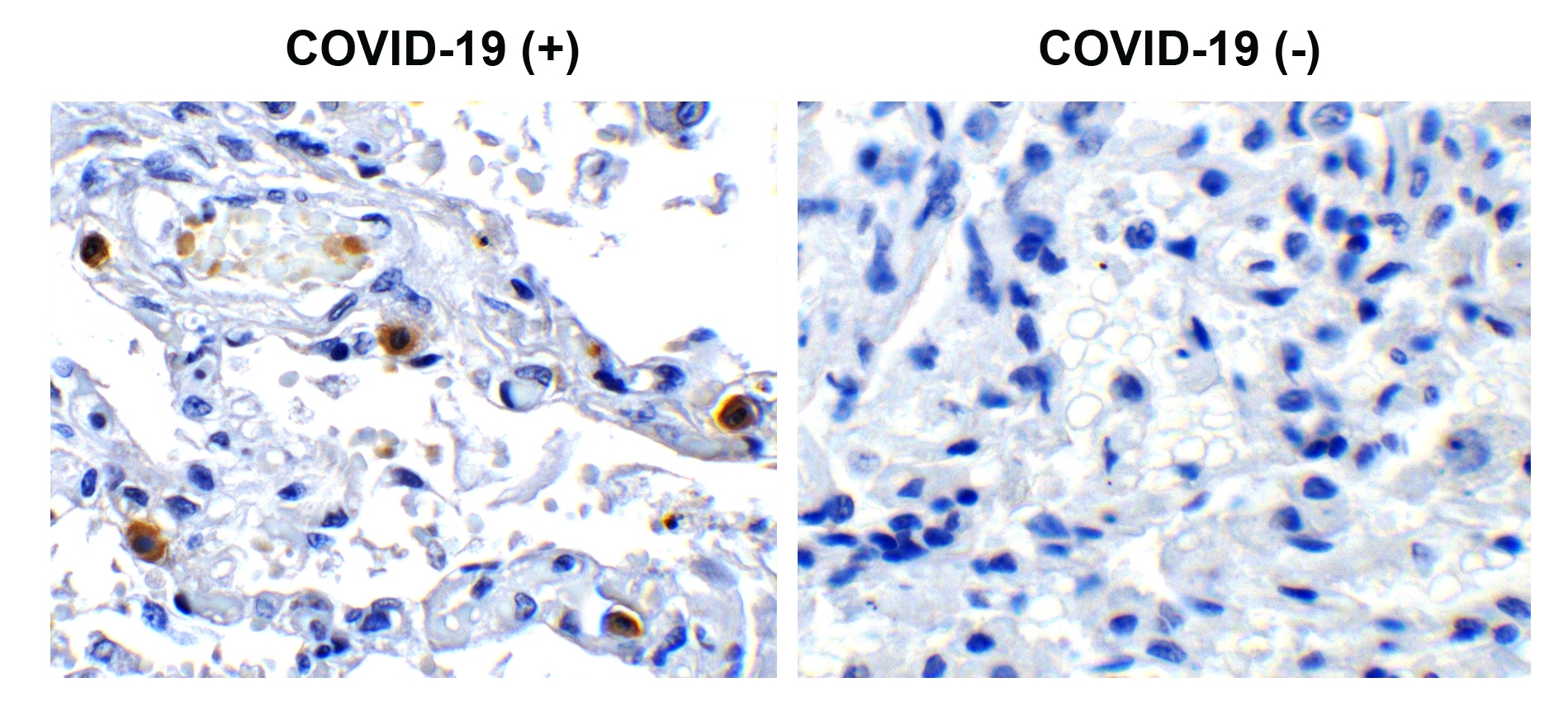SARS-CoV-2 (COVID-19) NSP16 Antibody