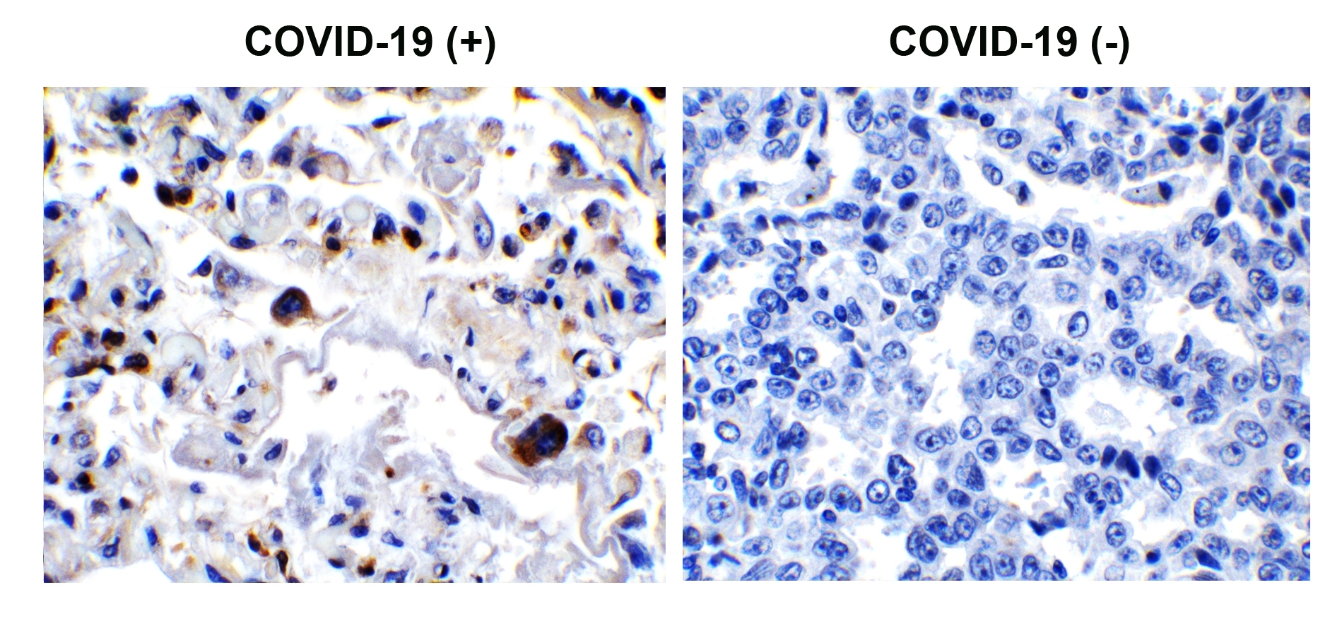 SARS-CoV-2 (COVID-19) 3CL-PRO (NSP5) Antibody
