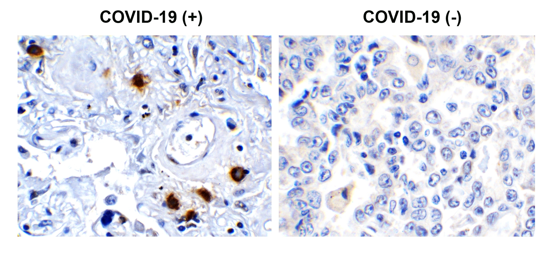 SARS-CoV-2 (COVID-19) NSP7 Antibody