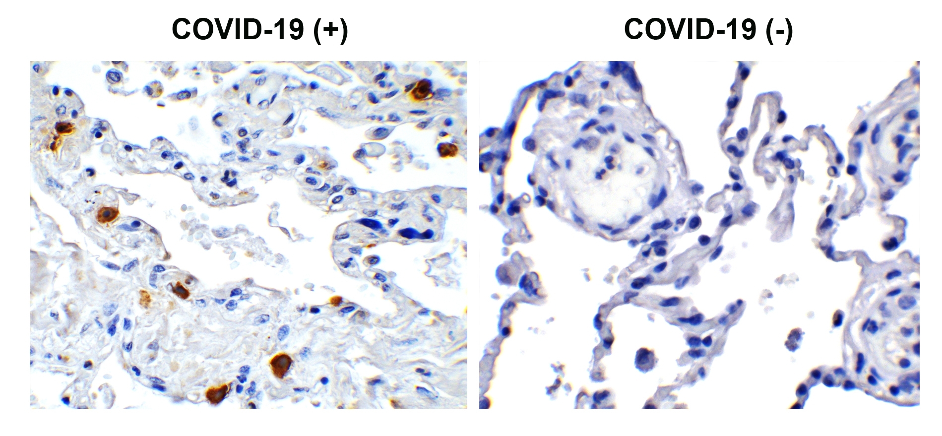 SARS-CoV-2 (COVID-19) NSP8 Antibody