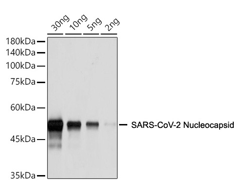SARS-CoV-2 (COVID-19) Nucleocapsid Antibody [ARC2372]