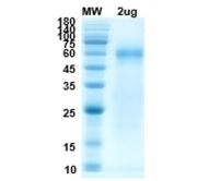 SARS-CoV-2 (COVID-19) Nucleocapsid Recombinant Protein