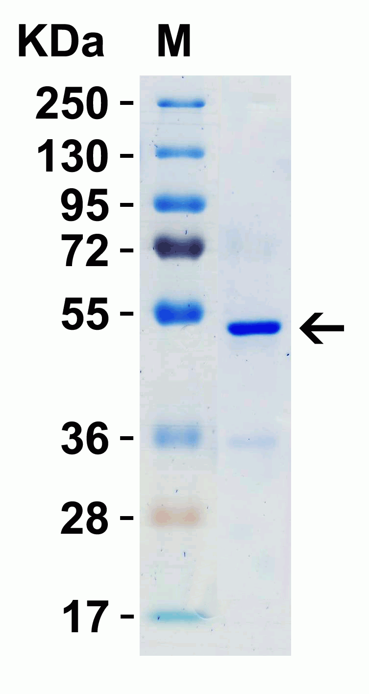 SARS-CoV-2 (COVID-19) Nucleocapsid Recombinant Protein