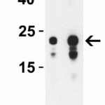 <strong>Figure 2 Western Blot Validation with SARS-CoV-2 (COVID-19) ORF3b Protein</strong><br>Loading: 30 ng per lane of SARS-CoV-2 (COVID-19) ORF3b recombinant protein (10-005).Antibodies: SARS-CoV-2 (COVID-19) ORF3b, 9277, 1h incubation at RT in 5% NFDM/TBST.Secondary: Goat anti-rabbit IgG HRP conjugate at 1:10000 dilution.Lane 1: 0.1 μg/mL and Lane 2: 0.2 μg/mL